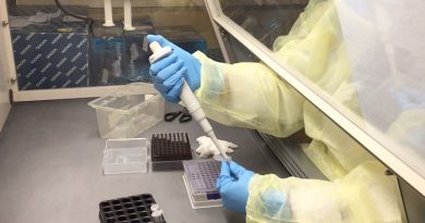 Realiza Laboratorio Estatal más de 12 mil estudios sanitarios en 2025: SSO